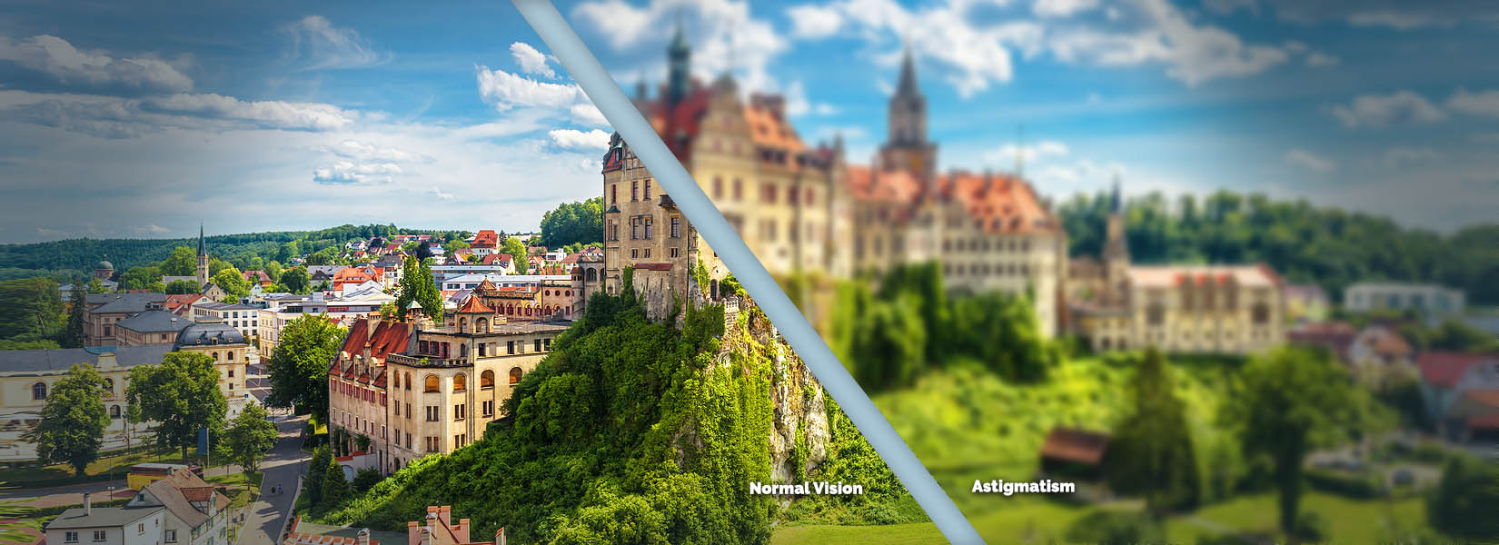 Astigmatism Treatment in Acton