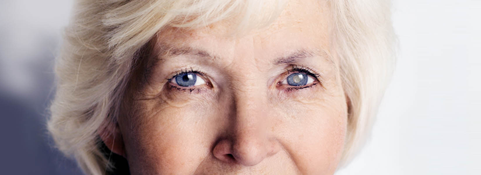 Cataract Surgery in Acton